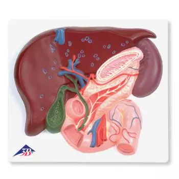 Hígado con vesícula biliar, páncreas y duodeno VE315