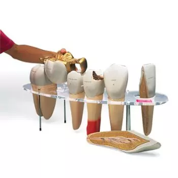 Modelo de prótesis dental, 7 piezas, 10 veces su tamaño natural - Inglés W42517
