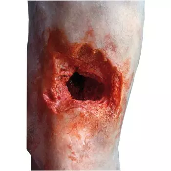 Simulador de pierna herida R50020 de Erler Zimmer