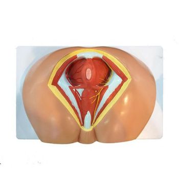 Modelo de perineo femenino