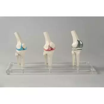 Modelo de prótesis de rodilla 1125 Erler Zimmer