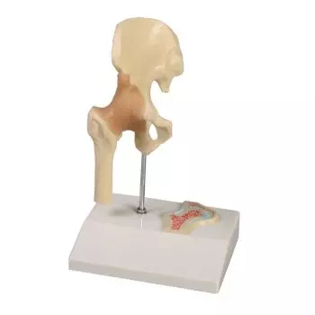 Articulación miniatura de la cadera con corte transversal Erler Zimmer
