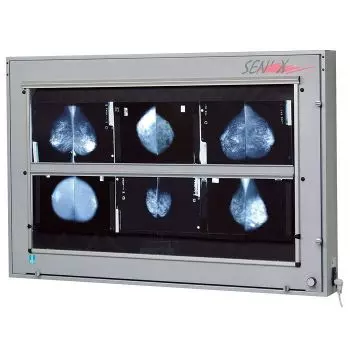Negatoscopio de mamografía de 2 rangos Serie SEN'X Ella Legros