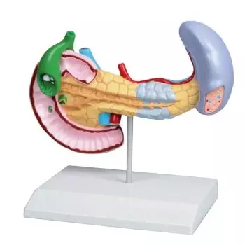 Modelo de páncreas, bazo y vesícula biliar con enfermedades Erler Zimmer