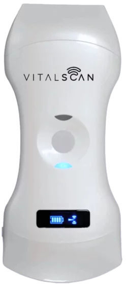 Ecógrafo ultraportátil conectado Vital Scan X5