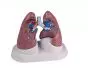 Set de pulmones enfermos G52 Erler Zimmer