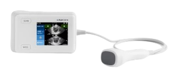 Escáner vesical Edgeflow UH10