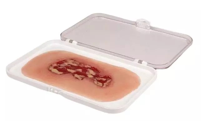 Modelo de una úlcera venosa en la pierna en fase de exudación