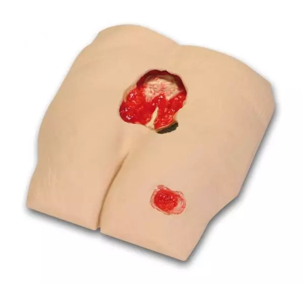 Modelo de úlcera por presión de categoría IV Erler Zimmer R10172