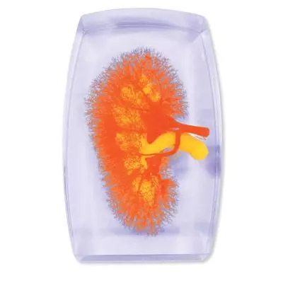Modelo de los vasos renales (rojo-amarillo) W10602