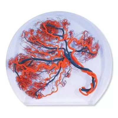 Modelo de placenta 3B Scientific W10604 