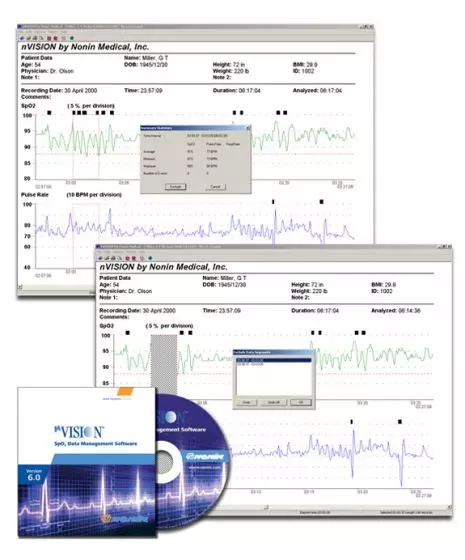 Software Nonin NVision Data Management CD-ROM Pack 1