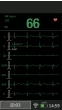 Monitor de pacientes portátil M850 SPO2-ECG