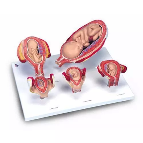 Serie 3B Scientific® de Embarazo, 5 Modelos L11/9