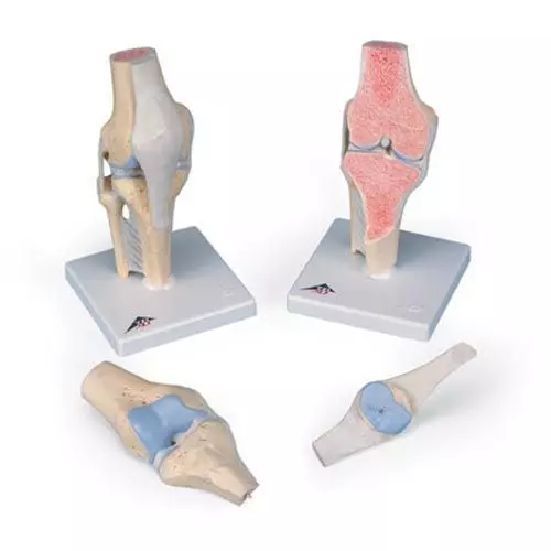 Modelo de la articulación de la rodilla, dividido en 3 partes 3B - A89