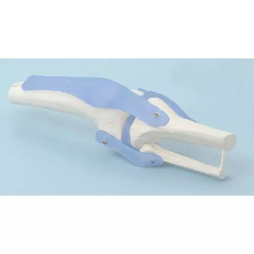 Articulación de la rodilla con ligamentos sin zocalate amovible Erler Zimmer