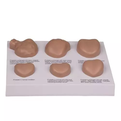 Modelo de examen de la próstata