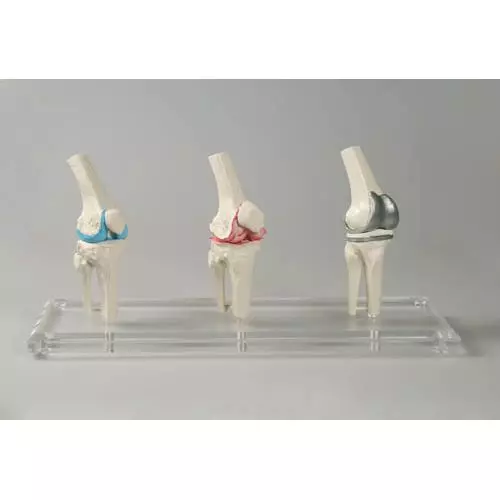 Modelo de prótesis de rodilla 1125 Erler Zimmer