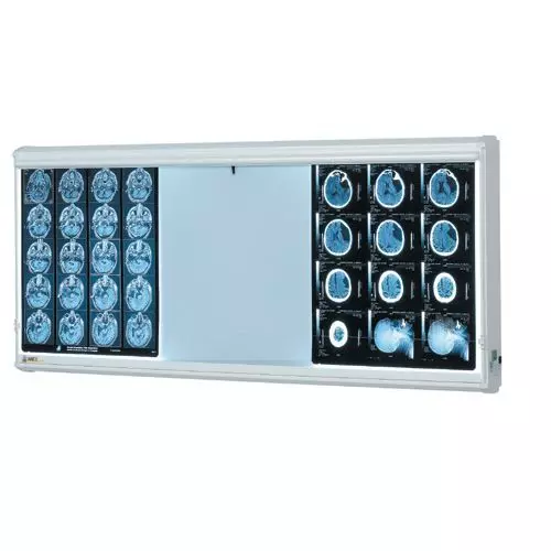 Negatoscopio de 2 paneles Série MAG'X Ella Legros﻿