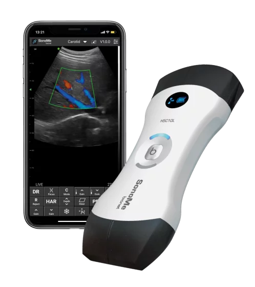 Ecógrafo ultraportátil conectado Bionet SonoMe