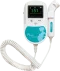 Doppler fetal y vascular portátil Sonoline C (con sonda de 2, 3 u 8 MHz)
