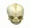 Modelo de cráneo de feto de 21 semanas ½ 4762 Erler Zimmer
