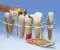 Modelo de prótesis dental, 7 piezas, 10 veces su tamaño natural - Alemán W42528