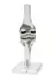 Modelo de rodilla con endoprótesis Erler Zimmer 4449