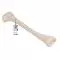 Tibia, izquierda A35/3L