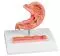 Modelo de estómago con úlcera péptica Erler Zimmer 