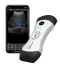 Ecógrafo ultraportátil conectado Bionet SonoMe