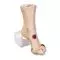 Modelo de pie herido Wilma™ 3B Scientific W46516