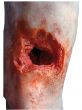Simulador de pierna herida R50020 de Erler Zimmer
