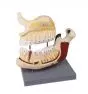 Modelo de maxilar y mandíbula humana D325 Erler Zimmer