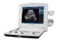 Ecógrafo portátil de ultrasonidos DUS60 de Edan