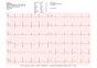 Electrocardiógrafo ECG Cardioline Touchecg HD+ Bluetooth (12 canales) para PC o tablet con Windows