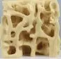 Modelo osteoporosis 4062 Erler Zimmer