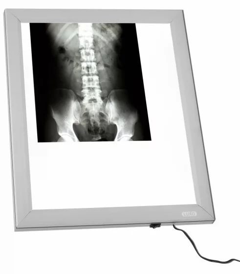 Negatoscopio Ulsan LED AF300