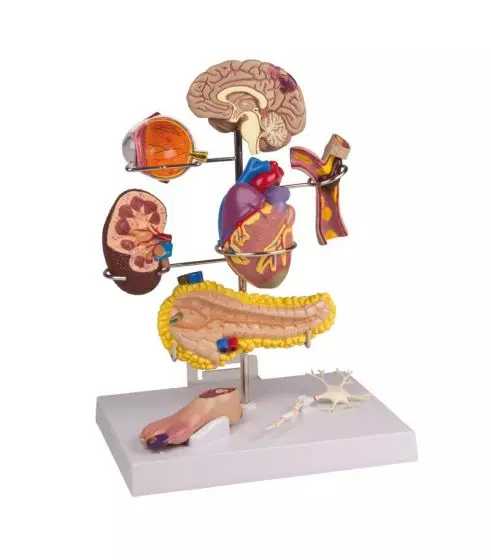 Set de demostración de diabetes tipo 2 G38 Erler Zimmer