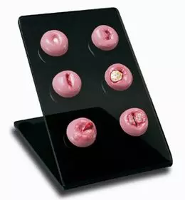 Réplica del cuello del útero con diferentes patologías W45078 3B Scientific