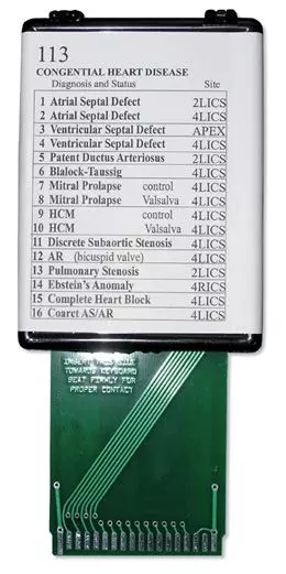 Cardiopatía congénita W49420