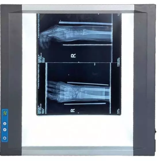 Visores LED extraplanos Devatoscopio con atenuador (1 ó 2 gamas)