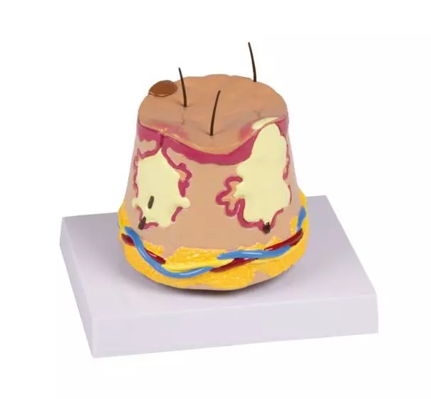 Modelo de piel acneica J50 Erler Zimmer