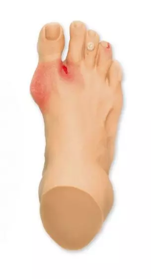 Modelo de pie con lesiones comunes R10035 Erler Zimmer