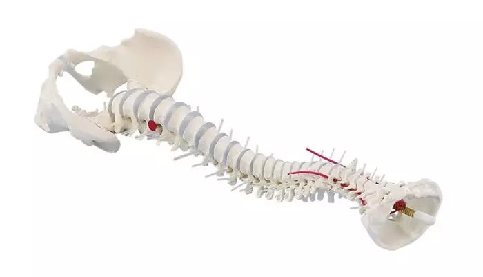 Modelo de columna vertebral con hernia discal, pelvis desmontable sin soporte 4024 Erler Zimmer