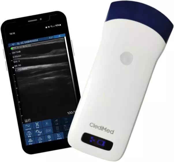Sonda de ultrasonido Wi-Fi ClediMed para smartphone y tablet