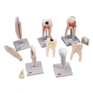 Serie de modelos dentales , 5 modelos 3B scientific - D10