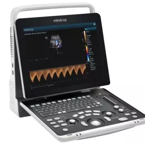 Ecógrafo portátil a ultrasonidos Mindray Z50