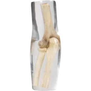 Erler Zimmer Radiografía de codo fantasma