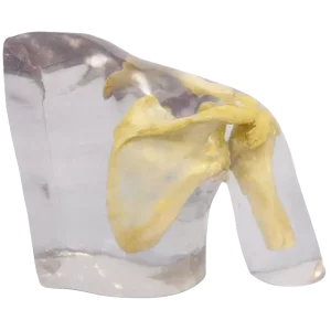 Fantasma radiográfico de hombro Erler Zimmer